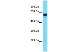 Host:  Rabbit  Target Name:  FOXO6  Sample Type:  Colorectal Tumor lysates  Antibody Dilution:  1. (Foxo6 抗体  (Middle Region))