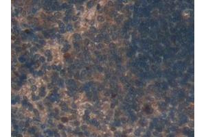 Immunohistochemistry (IHC) image for anti-Tubulin, delta 1 (TUBD1) (AA 238-482) antibody (ABIN7439597)