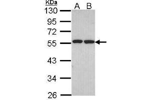 WB Image Sample (30 ug of whole cell lysate) A: H1299 B: Hela 10% SDS PAGE antibody diluted at 1:1000 (FAF2 抗体  (C-Term))