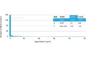 Analysis of Protein Array containing more than 19,000 full-length human proteins using Mesothelin Mouse Monoclonal Antibody (MSLN/3384). (Mesothelin 抗体  (AA 273-407))