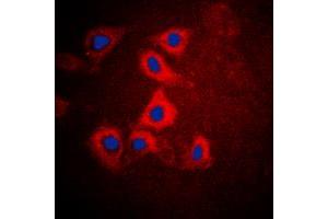 Immunofluorescent analysis of HEXB staining in HepG2 cells. (HEXB 抗体  (C-Term))