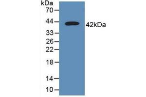 Western blot analysis of recombinant Human TSPAN30. (CD63 抗体  (AA 103-203))
