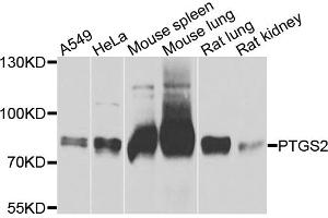 Western blot analysis of extracts of various cell lines, using PTGS2 antibody (ABIN6003505) at 1/1000 dilution. (PTGS2 抗体)