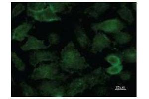 Immunostaining analysis in HeLa cells. (KAT5 抗体)