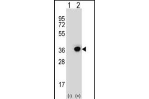 Western blot analysis of DHRS3 (arrow) using rabbit polyclonal DHRS3 Antibody (Center) (ABIN653135 and ABIN2842711). (DHRS3 抗体  (AA 85-113))