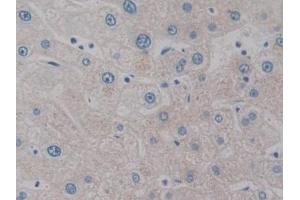 Detection of IL2 in Human Liver Tissue using Monoclonal Antibody to Interleukin 2 (IL2) (IL-2 抗体  (AA 21-153))