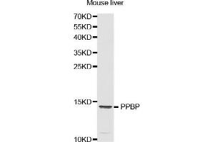 Western Blotting (WB) image for anti-Pro-Platelet Basic Protein (Chemokine (C-X-C Motif) Ligand 7) (PPBP) (AA 31-128) antibody (ABIN1513400) (CXCL7 抗体  (AA 31-128))