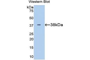 Western blot analysis of the recombinant protein. (LDHB 抗体  (AA 1-334))
