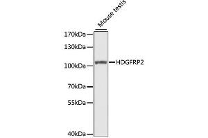 Western blot analysis of extracts of mouse testis, using HDGFRP2 antibody. (HDGFRP2 抗体)