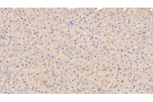 Detection of APOE in Rat Liver Tissue using Monoclonal Antibody to Apolipoprotein E (APOE) (APOE 抗体  (AA 19-168))