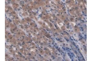 Detection of RIPK1 in Rat Stomach Tissue using Polyclonal Antibody to Receptor Interacting Serine Threonine Kinase 1 (RIPK1) (RIPK1 抗体  (AA 1-179))