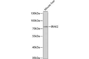 Western blot analysis of extracts of mouse liver, using IR antibody (ABIN3016606, ABIN3016607, ABIN3016608 and ABIN6219797) at 1:1000 dilution.