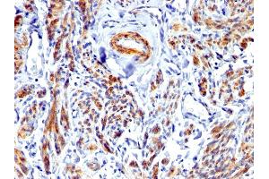 Formalin-fixed, paraffin-embedded human Uterus stained with Caldesmon Rabbit Polyclonal Antibody. (Caldesmon 抗体)