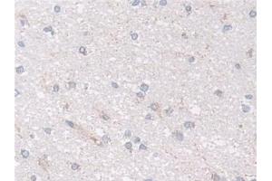 Immunohistochemistry (IHC) image for anti-NADH Dehydrogenase (Ubiquinone) Fe-S Protein 1, 75kDa (NADH-Coenzyme Q Reductase) (NDUFS1) (AA 524-727) antibody (ABIN7441598)