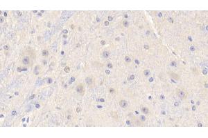 Detection of IGF1 in Mouse Cerebrum Tissue using Polyclonal Antibody to Insulin Like Growth Factor 1 (IGF1) (IGF1 抗体  (AA 33-102))