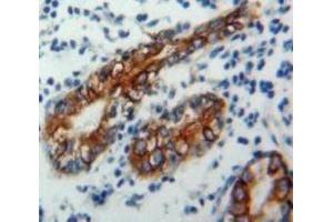 Used in DAB staining on fromalin fixed paraffin-embedded Stomach tissue (CD1d 抗体  (AA 64-298))