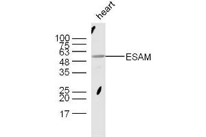 Mouse heart lysates probed with Rabbit Anti-ESAM Polyclonal Antibody, Unconjugated  at 1:300 overnight at 4˚C. (ESAM 抗体  (AA 21-120))