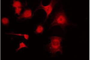 ABIN6274185 staining COLO205 by IF/ICC. (KAPC A/B 抗体)