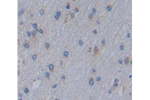 IHC-P analysis of Kidney tissue, with DAB staining. (IL1RAPL1 抗体  (AA 113-276))