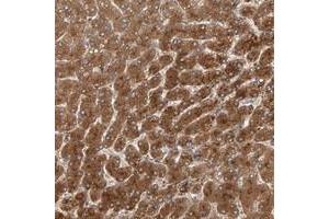 Immunohistochemical staining of human liver with ZNF160 polyclonal antibody  shows strong cytoplasmic positivity in hepatocytes. (ZNF160 抗体)
