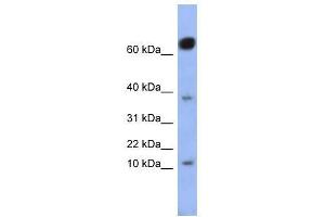NKX6-3 antibody used at 0. (NK6 Homeobox 3 抗体  (Middle Region))