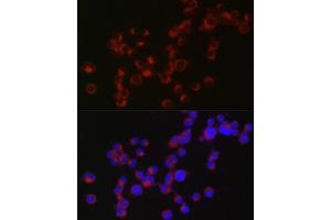 Immunofluorescence analysis of Neuro-2a cells using DCX Rabbit pAb (ABIN3021509, ABIN3021510, ABIN3021511 and ABIN6215166) at dilution of 1:50 (40x lens). (Doublecortin 抗体  (AA 11-360))