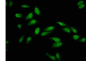 Immunofluorescence staining of Hela cells with ABIN7163794 at 1:133, counter-stained with DAPI. (PCGF1 抗体  (AA 113-187))