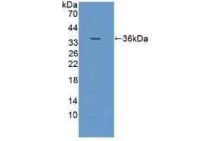 Detection of Recombinant EPCAM, Porcine using Polyclonal Antibody to Epithelial Cell Adhesion Molecule (EPCAM) (EpCAM 抗体  (AA 25-265))