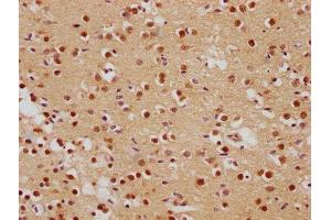 IHC image of ABIN7139839 diluted at 1:500 and staining in paraffin-embedded human brain tissue performed on a Leica BondTM system. (Foxo6 抗体  (AA 211-218))