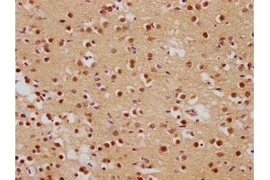 IHC image of ABIN7139839 diluted at 1:500 and staining in paraffin-embedded human brain tissue performed on a Leica BondTM system. (Foxo6 抗体  (AA 211-218))