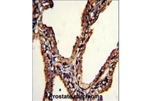 Immunohistochemistry (Paraffin-embedded Sections) (IHC (p)) image for anti-Proteasome (Prosome, Macropain) Subunit, beta Type, 9 (Large Multifunctional Peptidase 2) (PSMB9) (AA 193-219), (C-Term) antibody (ABIN652496)