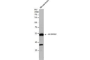 WB Image ALDH1A2 antibody detects ALDH1A2 protein by western blot analysis. (ALDH1A2 抗体)