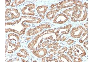 Formalin-fixed, paraffin-embedded human Prostate stained with ODC1 Rabbit Recombinant Monoclonal Antibody (ODC1/2878R). (Recombinant ODC1 抗体)