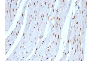 Immunohistochemistry (IHC) image for anti-Small Ubiquitin Related Modifier 2 (SUMO2) antibody (ABIN6940603)