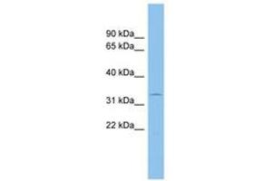 Image no. 1 for anti-Acid Phosphatase 5, Tartrate Resistant (ACP5) (AA 71-120) antibody (ABIN6744708) (ACP5 抗体  (AA 71-120))