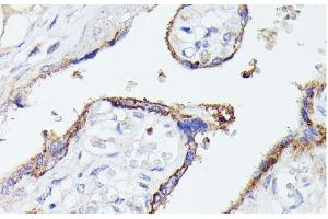 Immunohistochemistry of paraffin-embedded Human placenta using LTF Polyclonal Antibody at dilution of 1:100 (40x lens). (Lactoferrin 抗体)