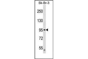 Western blot analysis of DTX3L / BBAP Antibody  in SK-BR-3 cell line lysates (35ug/lane). (DTX3L 抗体  (Middle Region))