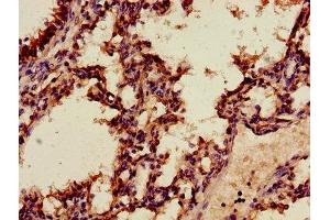 Immunohistochemistry of paraffin-embedded human lung tissue using ABIN7144268 at dilution of 1:100 (Annexin A2 抗体  (AA 2-339))