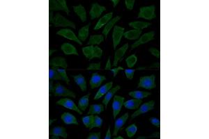 Immunofluorescence (IF) image for anti-Cytochrome C Oxidase Assembly Homolog 15 (COX15) (AA 150-250) antibody (ABIN7266634)