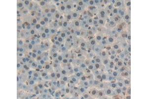 Immunohistochemistry (IHC) image for anti-Dyskeratosis Congenita 1, Dyskerin (DKC1) (AA 298-509) antibody (ABIN5013473)