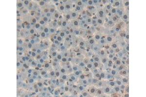 Used in DAB staining on fromalin fixed paraffin- embedded liver tissue (DKC1 抗体  (AA 298-509))