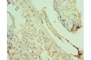 Immunohistochemistry of paraffin-embedded human testis tissue using ABIN7158699 at dilution of 1:100 (KDM4B 抗体  (AA 1-260))