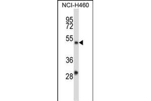 YY2 Antibody (C-term) (ABIN657589 and ABIN2846590) western blot analysis in NCI- cell line lysates (35 μg/lane). (YY2 抗体  (C-Term))