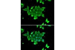 Immunofluorescence (IF) image for anti-phosphohistidine Phosphatase 1 (PHPT1) (AA 1-125) antibody (ABIN6215139) (PHPT1 抗体  (AA 1-125))