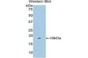 Western Blotting (WB) image for anti-Periostin (POSTN) (AA 500-630) antibody (ABIN1860279)