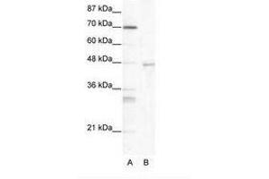 Image no. 1 for anti-Heat Shock Transcription Factor 4 (HSF4) (AA 172-221) antibody (ABIN203154) (HSF4 抗体  (AA 172-221))