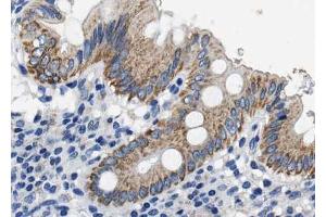 ABIN6268714 at 1/100 staining human colon tissue sections by IHC-P.