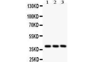 Western Blotting (WB) image for anti-Prostaglandin E Receptor 2 (Subtype EP2), 53kDa (PTGER2) (AA 281-308), (C-Term) antibody (ABIN3043363) (PTGER2 抗体  (C-Term))