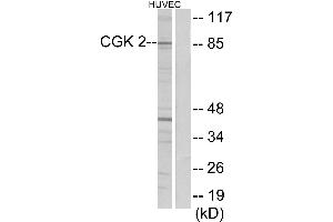 Western blot analysis of extracts from HUVEC cells, using CGK 2 antibody. (PRKG2 抗体)