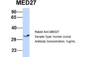 Host: Rabbit Target Name: MED27 Sample Type: Jurkat Antibody Dilution: 1. (MED27 抗体  (Middle Region))